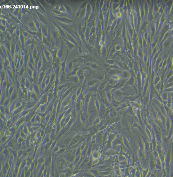 C166С��Ѫ�܃�(n��i)Ƥ��(x��)��